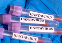 Pacientă în stare critică la Paris după focarul de hantavirus pe nava MV Hondius