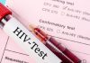 ONU avertizează: Finanțarea pentru combaterea HIV s-a prăbușit, iar riscul unei noi creșteri a infectărilor este tot mai mare
